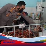 Kapolres Sukabumi Kota Pantau Perkembangan Kesehatan Muhammad Shiddiq Amirullah Balita Yang Mengalami Gizi Buruk