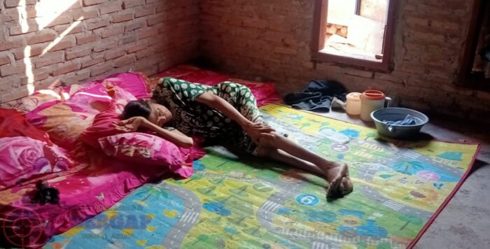 Alami Kelumpuhan, Rosliyana Harapkan Bantuan Kursi Roda